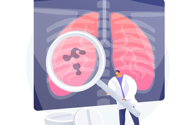 OSPAÑA y el tratamiento de la Tuberculosis